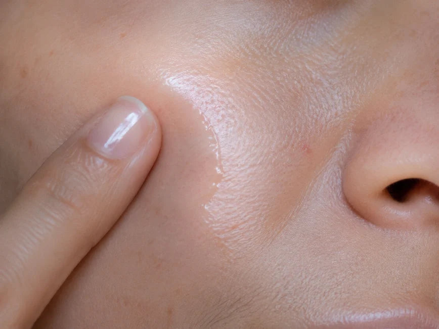 Why Is My Skin So Dry Even After Moisturizing?